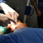 ¿Qué es el procedimiento Facetite? Beneficios, complicaciones, recuperación y costo