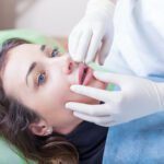 how to prevent lip filler migration