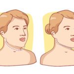 best Ways to Reduce Double Chin Quickly