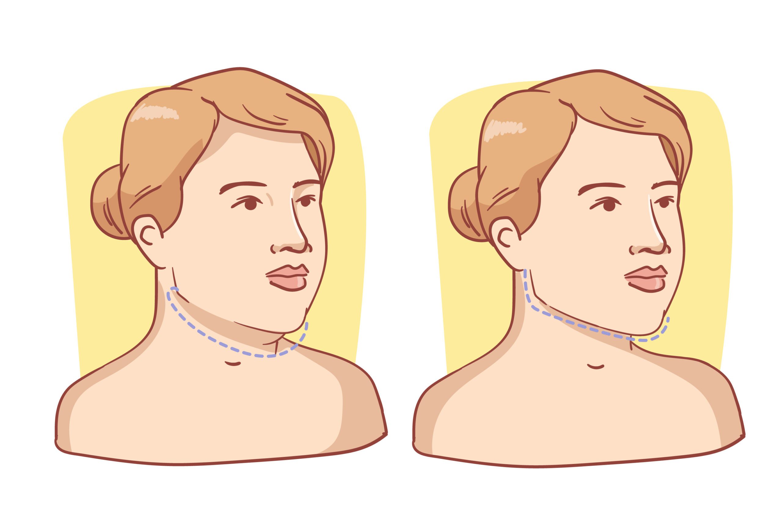 best Ways to Reduce Double Chin Quickly scaled