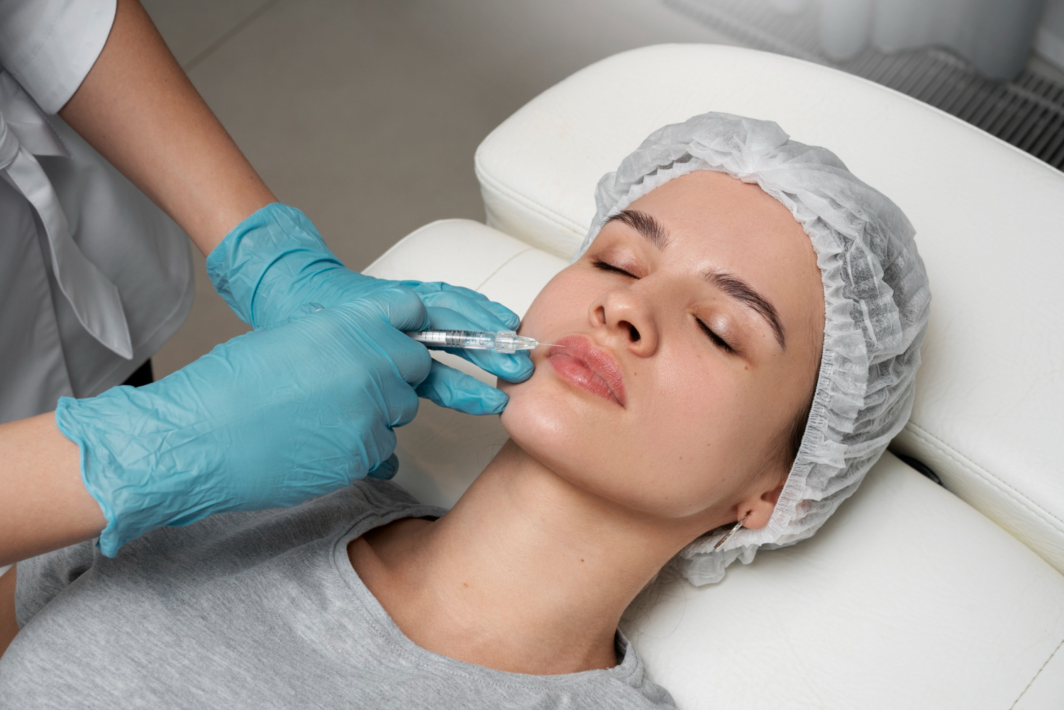 Do Lip Fillers Dissolve Over Time