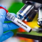 Lipid Test Analyzer: Understand Your Cholesterol Results
